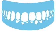 口が閉じない(開咬)