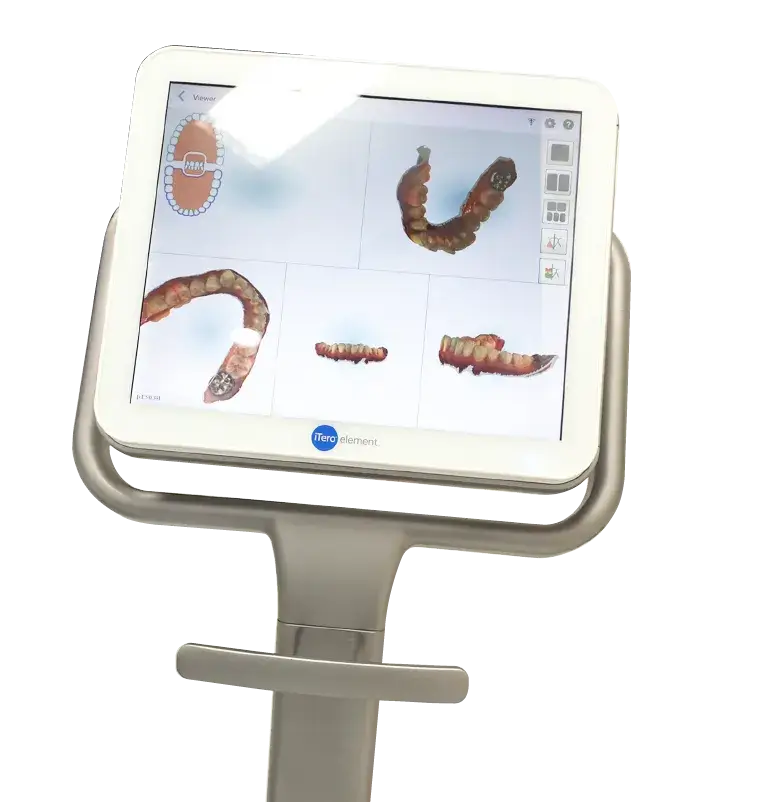 シミュレーションで治療をイメージ!